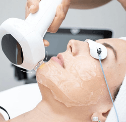 Lumecca Photo Facial treatment